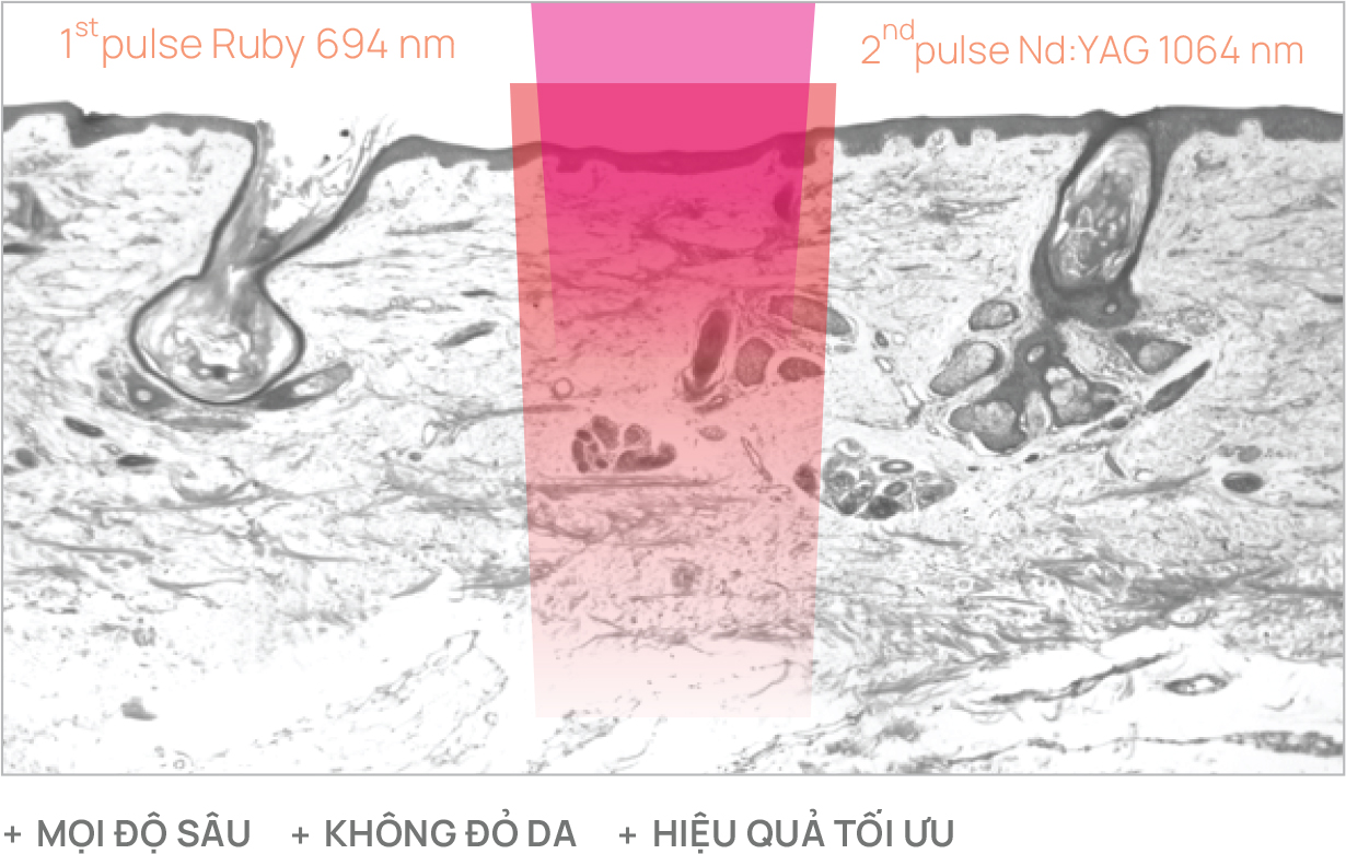 Trước điều trị